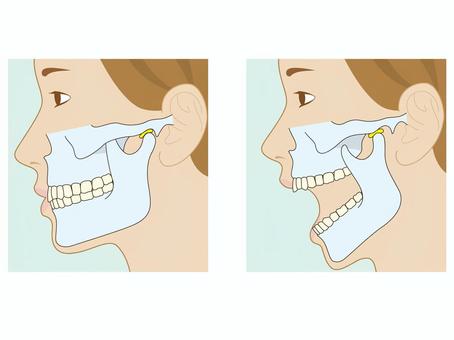 顎が痛い　顎関節症　＊　東大阪　歯医者　安部歯科医院