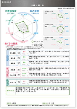 タイプB