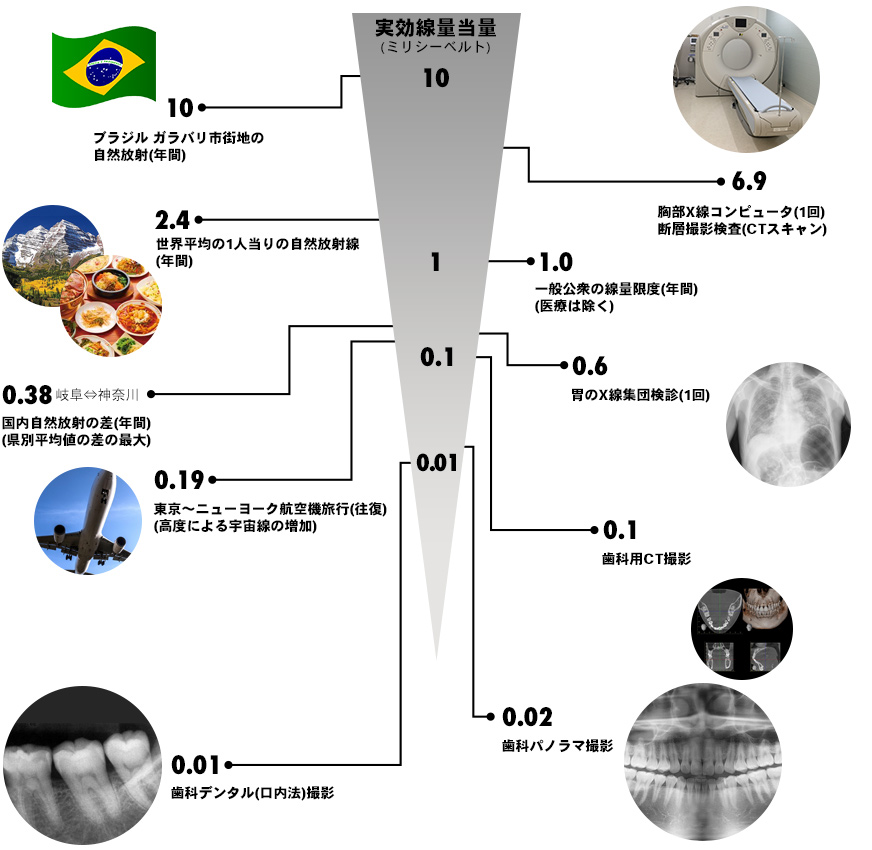 実効線量当量（ミリシーベルト） 歯科デジタルX線写真（部分的）0.01 歯科デジタルパノラマ写真撮影0.02